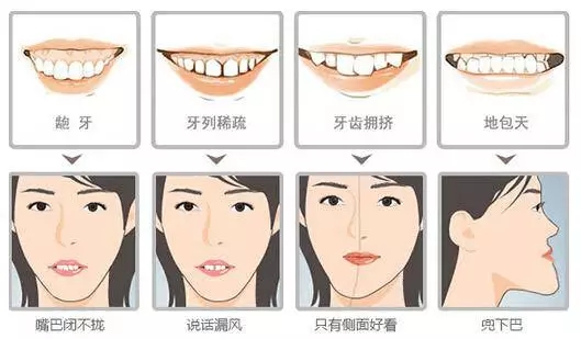 矫正牙齿什么年龄好